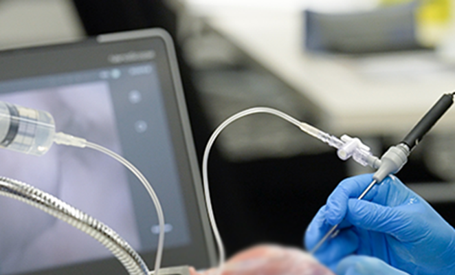 関節鏡スコープとそれを持つ手