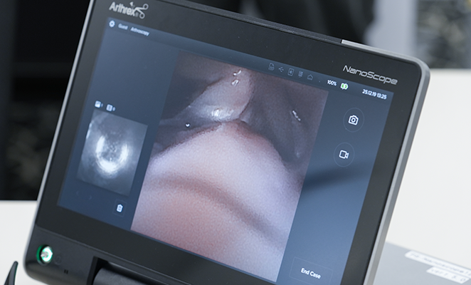 モニターに関節内の映像が映っている様子