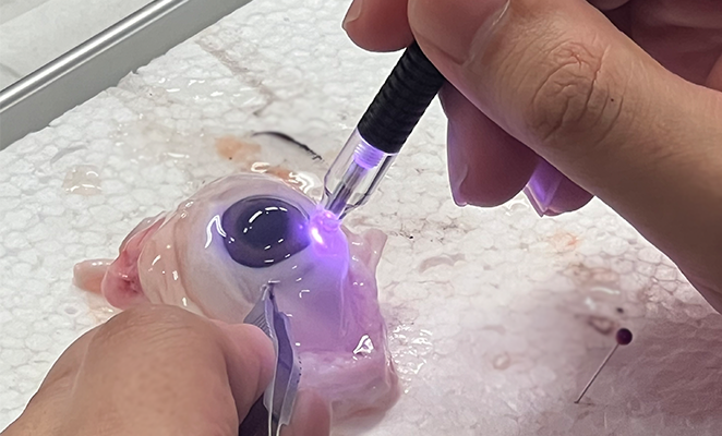 豚眼にレーザーを当てて、ピンセットで押さえている様子。経強膜毛様体光凝固術（TSCP）